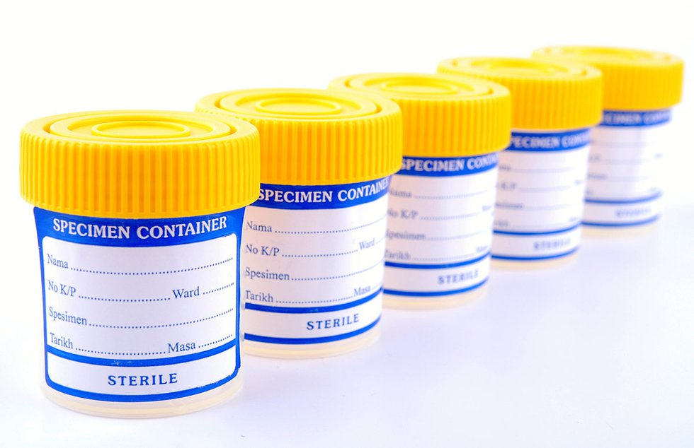 Medical specimen containers